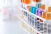 Analytical-Chemistry_GettyImages-482186655_2000px