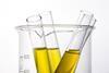 Test tubes with urine samples