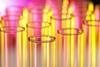 A close-up photograph of the tops of glass test tubes in a laboratory